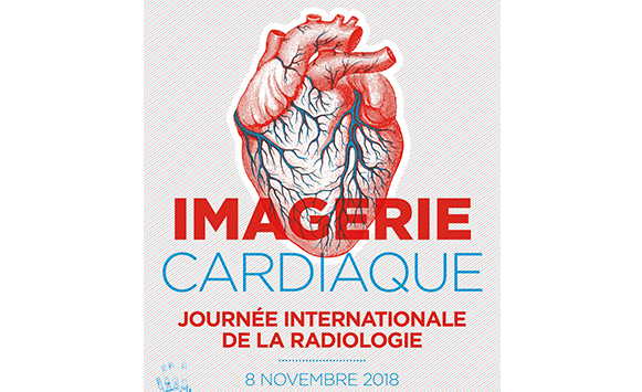 Poster - International Day of Radiology - 2018 - FR